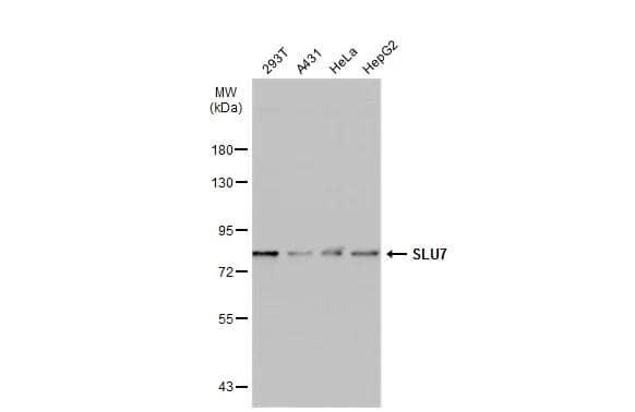 Various whole cell extracts (30 ug) were separated by 7.5% SDS-PAGE, and the membrane was blotted with SLU7 antibody (NBP2-43794) diluted at 1:1000. The HRP-conjugated anti-mouse IgG antibody  was used to detect the primary antibody, and the signal was developed with Trident ECL plus-Enhanced. 