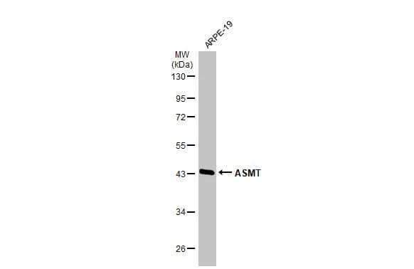 Western Blot ASMT Antibody - BSA Free
