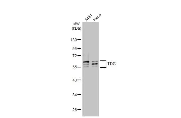 Western Blot: TDG Antibody (311) [NBP2-43802] - Various whole cell extracts (30 ug) were separated by 10% SDS-PAGE, and the membrane was blotted with TDG antibody [GT311] (NBP2-43802) diluted at 1:1000. The HRP-conjugated anti-mouse IgG antibody  was used to detect the primary antibody, and the signal was developed with Trident ECL plus-Enhanced.