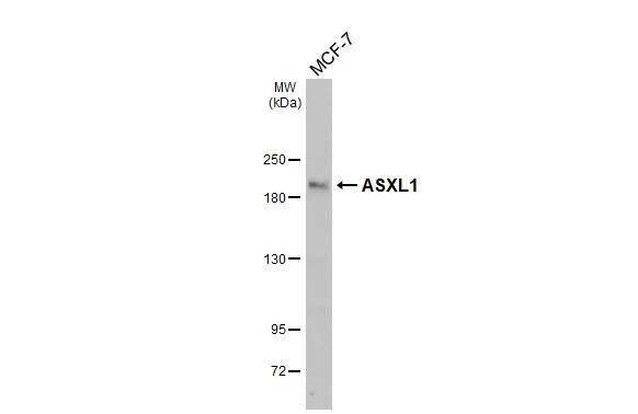 Whole cell extract (30 ug) was separated by 5% SDS-PAGE, and the membrane was blotted with ASXL1 antibody (NBP2-43807) diluted at 1:5000. The HRP-conjugated anti-rabbit IgG antibody  was used to detect the primary antibody. 