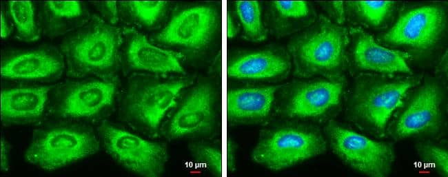 Fatty Acid Synthase antibody [GT325] detects Fatty Acid Synthase protein at cytoplasm by immunofluorescent analysis.Sample: HeLa cells were fixed in ice-cold MeOH for 5 min.Green: Fatty Acid Synthase stained by Fatty Acid Synthase antibody [GT325] (NBP2-43822) diluted at 1:200.Blue: Hoechst 33342 staining.Scale bar= 10um. 