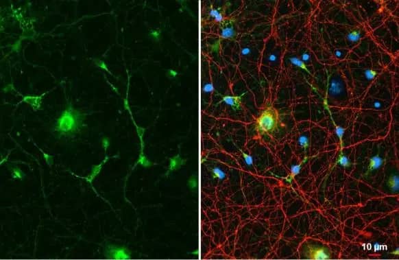 Immunocytochemistry/ Immunofluorescence: Glutamine Synthetase Antibody (7711) [NBP2-43826] - Glutamine Synthetase antibody [GT7711] detects Glutamine Synthetase protein in glial cells by immunofluorescent analysis.Sample: DIV10 rat E18 primary cortical neuron & glia cells were fixed in 4% paraformaldehyde at RT for 15 min.Green: Glutamine Synthetase stained by Glutamine Synthetase antibody [GT7711] (NBP2-43826) diluted at 1:500.Red: Tau, a Tau marker, stained by Tau antibody  diluted at 1:500.Blue: Fluoroshield with DAPI .