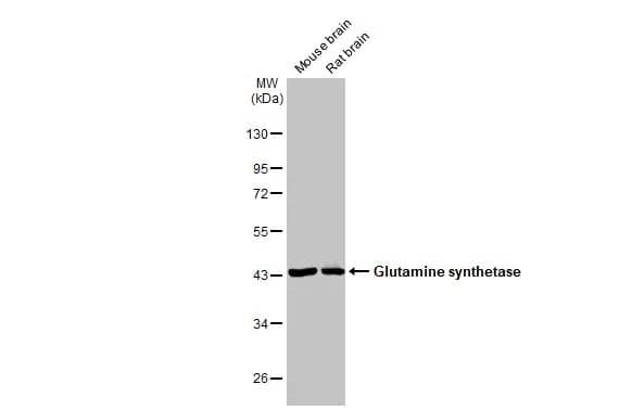 Western Blot: Glutamine Synthetase Antibody (7711) [NBP2-43826] - Various tissue extracts (50 ug) were separated by 10% SDS-PAGE, and the membrane was blotted with Glutamine Synthetase antibody [GT7711] (NBP2-43826) diluted at 1:250000. The HRP-conjugated anti-mouse IgG antibody  was used to detect the primary antibody.