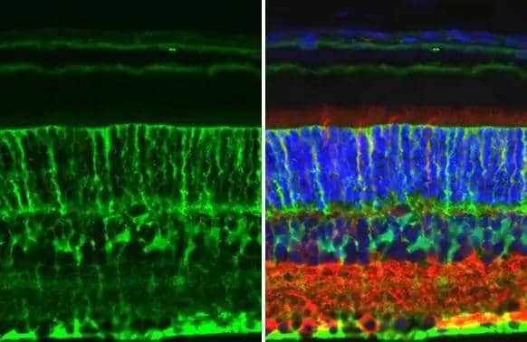 Glutamine synthetase antibody [GT7711] detects Glutamine synthetase protein at cell membrane by immunohistochemical analysis.Sample: Paraffin-embedded mouse eye.Green: Glutamine synthetase stained by Glutamine synthetase antibody [GT7711] (NBP2-43826) diluted at 1:200.Red: beta Tubulin 3/ Tuj1 , a Cytoskeleton marker, stained by beta Tubulin 3/ Tuj1 antibody [GT11710]  diluted at 1:500.Blue: Fluoroshield with DAPI .Antigen Retrieval: Citrate buffer, pH 6.0, 15 min 