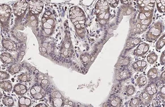 Glutamine synthetase antibody [GT7711] detects Glutamine synthetase protein at cell membrane and cytoplasm by immunohistochemical analysis.Sample: Paraffin-embedded mouse colon.Glutamine synthetase stained by Glutamine synthetase antibody [GT7711] (NBP2-43826) diluted at 1:200.Antigen Retrieval: Citrate buffer, pH 6.0, 15 min 