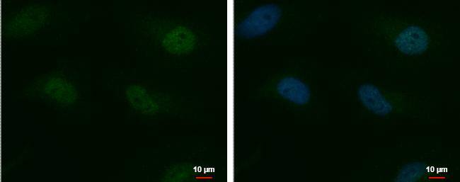 MTF2 antibody detects MTF2 protein at nucleus by immunofluorescent analysis. Sample: HeLa cells were fixed in 4% paraformaldehyde/PBS for 15 min.Green: MTF2 protein stained by MTF2 antibody (NBP2-43828) diluted at 1:500.Blue: Hoechst 33342 staining. 