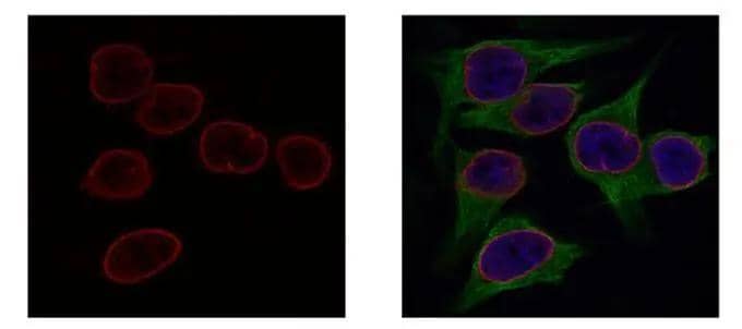 Immunocytochemistry/ Immunofluorescence Lamin B2 Antibody (144) - Azide and BSA Free