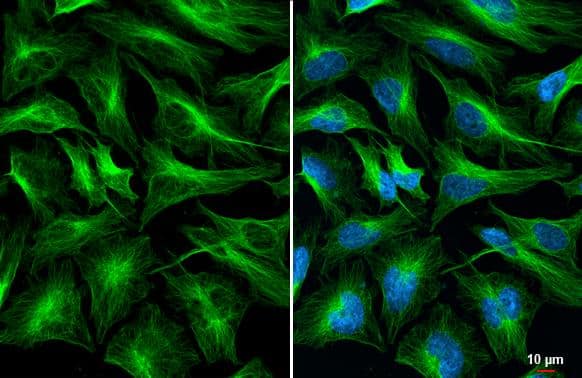 Immunocytochemistry/ Immunofluorescence Tubulin alpha-1B Antibody (114) - Azide and BSA Free