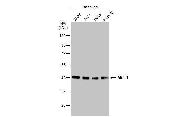 Unboiled various whole cell extracts (30 ug) were separated by 10% SDS-PAGE, and the membrane was blotted with MCT1 antibody [GT14612] (NBP2-43838) diluted at 1:1000. The HRP-conjugated anti-mouse IgG antibody  was used to detect the primary antibody, and the signal was developed with Trident ECL plus-Enhanced. 