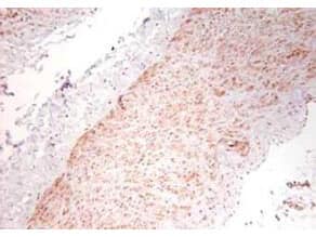 Immunohistochemistry using polyclonal TNFa antibody showing staining of formalin/PFA-fixed paraffin-embedded sections of human artery tissue sections. Sections were fixed in formaldehyde and subjected to heat mediated antigen retrieval in citrate buffer (pH 6.0). Slides were blocked for ten minutes with 1.5% serum.  Primary antibody was diluted 1:100 and incubated with samples for 24 hours at 4C.  HRP-conjugated goat anti-rabbit antibody was used as the secondary antibody.