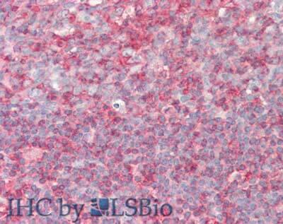 Immunohistochemistry of PIP5K1 alpha Antibody.  Tissue: Tonsil.  Fixation: formalin fixed paraffin embedded.  Antigen retrieval: not required. Primary antibody: PIP5K1A antibody at 5 ug/mL for 1 h at RT. Secondary antibody: Peroxidase rabbit secondary antibody at 1:10,000 for 45 min at RT. Staining: PIP5K1A as precipitated red signal with hematoxylin purple nuclear counterstain.