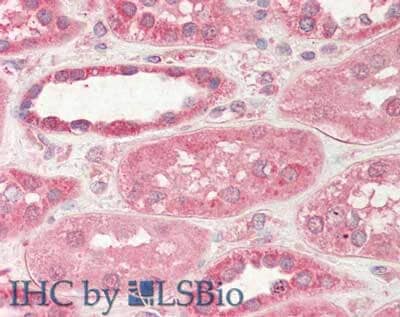 Immunohistochemistry of Sheep STIM2 Antibody.  Tissue: Kidney.  Fixation: formalin fixed paraffin embedded.  Antigen retrieval: not required. Primary antibody: STIM2 antibody at 5 ug/mL for 1 h at RT. Secondary antibody: Peroxidase sheep secondary antibody at 1:10,000 for 45 min at RT. Staining: STIM2 as precipitated red signal with hematoxylin purple nuclear counterstain.