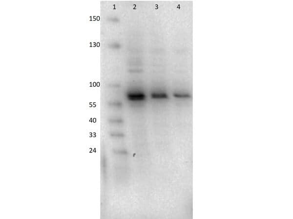 Western Blot of AKT2 Antibody (11F6.B2) antibody.  Lane 1: Molecular Weight Marker.  Lane 2: LnCap lysate 