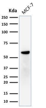 Western Blot Analysis of human MCF-7 cell lysate using ER beta/NR3A2 Antibody (ERb455) - IHC-Prediluted.
