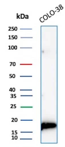 Western Blot Analysis of Colo-38 lysate using Melan-A/MART-1 Antibody (M2-7C10) - IHC-Prediluted.