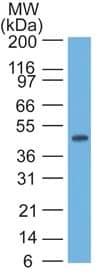 Western blot of HeLa lysate using Cytokeratin 17 Antibody (E3 (same as Ks17.E3)) - IHC-Prediluted.