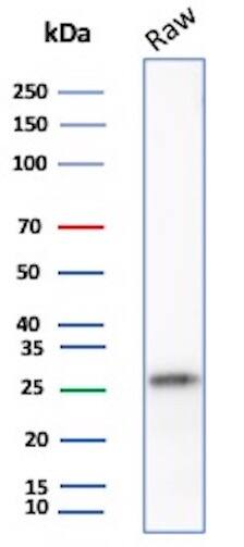Western blot analysis of Raw lysate using p27/Kip1 Antibody (SX53G8) - IHC-Prediluted.