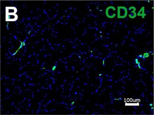 Immunocytochemistry/ Immunofluorescence: CD34 Antibody (HPCA1/763) [NBP2-44568] - Immunofluorescence staining of retained human SVF adjacent to the site of cell-seeded scaffold transplantation. (A) Human SVF are visualized using human specific nuclear matrix antigen (NuMA). Immunofluorescence imaging of human-specific antibodies targeting CD34 (B) & CD31 (C). Scale bar: 50 μm (A), 100 μm (B,C). Image collected & cropped by CiteAb from the following publication (//pubmed.ncbi.nlm.nih.gov/32766213), licensed under a CC-BY license. Not internally tested by Novus Biologicals.