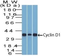 Western Blot Analysis of Cyclin D1 in (1) C2C12, (2) HepG2, & (3) NIH3T3 lysate with Cyclin D1 Antibody (SPM587) - IHC-Prediluted.