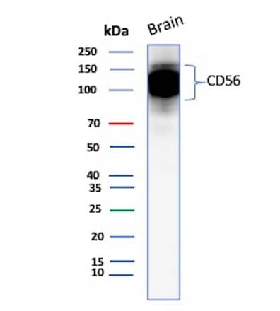 Western blot analysis of  Human Brain tissue lysates using NCAM-1/CD56 Antibody (123C3.D5) - IHC-Prediluted.