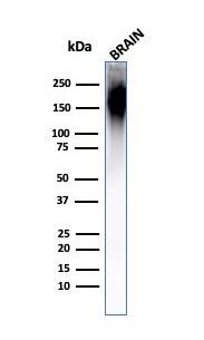 Western Blot Analysis of Human Brain Tissue Lysate using NF-H Antibody (NF421) - IHC-Prediluted.