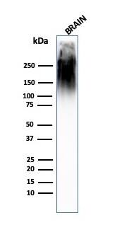Western Blot Analysis of human brain tissue lysate using NF-H Antibody (SPM563) - IHC-Prediluted.