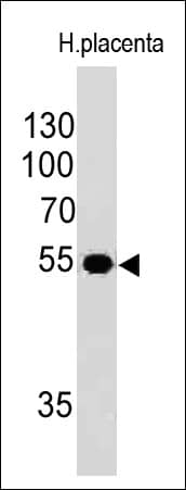 Western blot analysis of human placental tissue lysate using Ornithine Decarboxylase Antibody (ODC1/485) - IHC-Prediluted.