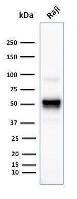 Western Blot Analysis of human Rajj cell lysate using CD79A Antibody (SPM549) - IHC-Prediluted.