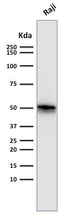 Western Blot Analysis of Raji cell lysate using CD79A Antibody (SPM550) - IHC-Prediluted.