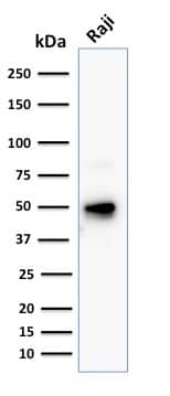 Western Blot Analysis of human Raji cell lysate using CD79A Antibody (JCB117 + HM47/A9) - IHC-Prediluted.