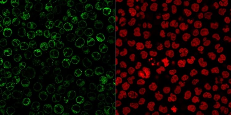 Immunofluorescent staining of paraformaldehyde-fixed Raji cells. CD79A Antibody (JCB117 + HM47/A9) - IHC-Prediluted followed by goat anti-Mouse IgG-CF488 (Green). The nuclear counterstain is Reddot (Red)