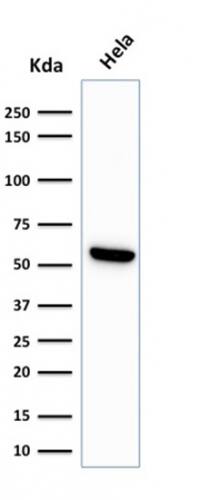 Western Blot Analysis of HeLa cell lysate using HSP60 Antibody (LK1) - IHC-Prediluted