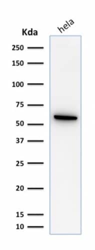 Western Blot Analysis of HeLa cell lysate using HSP60 Antibody (SPM253) - IHC-Prediluted
