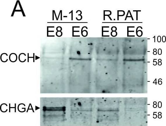 Western blot confirmation of marker proteins.Equal quantities of protein from media supernatant from cells cultured as described in Fig 1 were run on Western blot and probed with antibodies for an E8-enriched marker protein (CHGA, NID1, SEMA3 or NPTX3) and an E6-enriched marker protein (COCH, FGFR1, Follistatin or OLFML3). Membranes were imaged using LICOR Odyssey system. Image collected and cropped by CiteAb from the following open publication (//pubmed.ncbi.nlm.nih.gov/38875182), licensed under a CC-BY license. Not internally tested by Novus Biologicals.