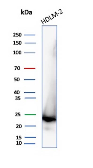 Western Blot Analysis of HDLM-2 lysate using Bcl-2 Antibody (8C8) - IHC-Prediluted.