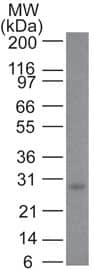 Western Blot Analysis of Bcl-2 in human skin using Bcl-2 Antibody (100/D5+124) - IHC-Prediluted.