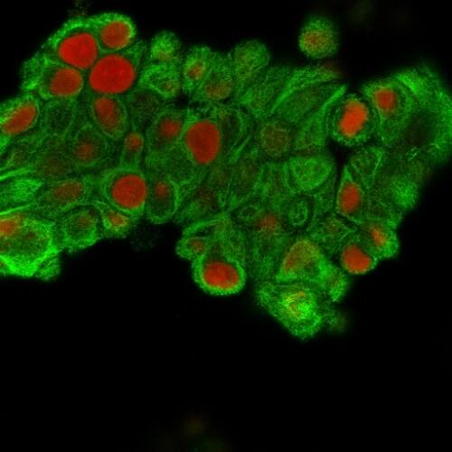 Immunofluorescence Analysis of MeOH-fixed MCF-7 cells labeling CK19 using Cytokeratin 19 Antibody (SPM561) - IHC-Prediluted followed by Goat anti-Mouse IgG-CF488 (Green). The nuclear counterstain is Reddot (Red)