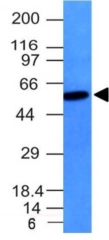 Western blot analysis Raji cell lysate Vimentin Antibody (VM452) - IHC-Prediluted.