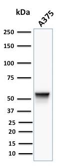 Western blot analysis of human A375 cell lysate using Vimentin Antibody (VM452) - IHC-Prediluted.
