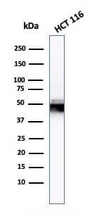 Western Blot Analysis of HCT116 cell lysate using Cytokeratin 8 Antibody (H1) - IHC-Prediluted.