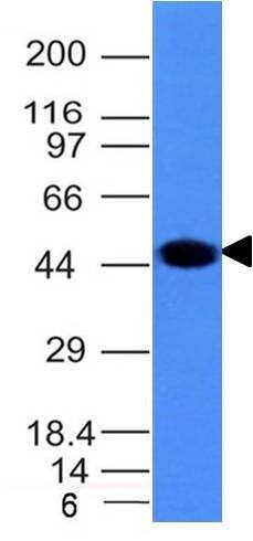 Western Blot Analysis of A431 cell lysate using Cytokeratin 8 Antibody (H1) - IHC-Prediluted.