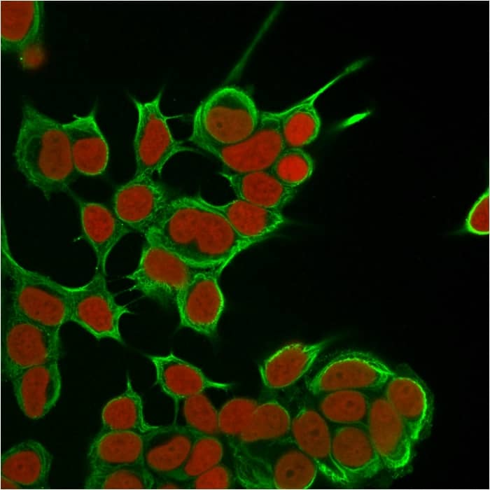Immunofluorescent staining of MCF-7 cells using Cytokeratin 8 Antibody (SPM538) - IHC-Prediluted followed by goat anti-Mouse IgG-CF488 (Green). The nuclear counterstain is Reddot. (Red).
