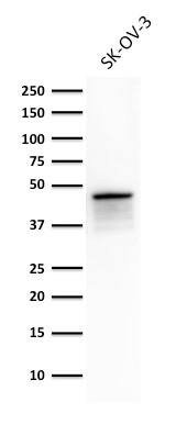Western Blot Analysis of SK-OV-3 cell lysate using Cytokeratin 8 Antibody (TS1) - IHC-Prediluted.