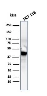 Western Blot Analysis of HCT116 cell lysate using Cytokeratin 8 Antibody (SPM192) - IHC-Prediluted.