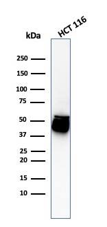 Western Blot Analysis of HCT116 cell lysate using Cytokeratin 8 Antibody (H1+TS1) - IHC-Prediluted.