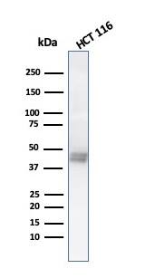 Western Blot Analysis of HCT116 cell lysate using CK8 with Cytokeratin 8 Antibody (K8.8) - IHC-Prediluted.