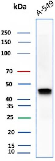 Western Blot Analysis of A-549 lysate using Cytokeratin 18 Antibody (DC10) - IHC-Prediluted