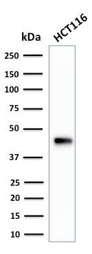Western Blot Analysis of HCT116 cell lysate using Cytokeratin 18 Antibody (SPM265) - IHC-Prediluted.