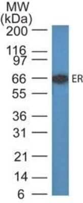 Western Blot: ER alpha/NR3A1 Antibody (SPM567) - IHC-Prediluted [NBP2-45004] - Western blot analysis of Estrogen Receptor in MCF-7 lysate using Estrogen Receptor Ab (SPM567).