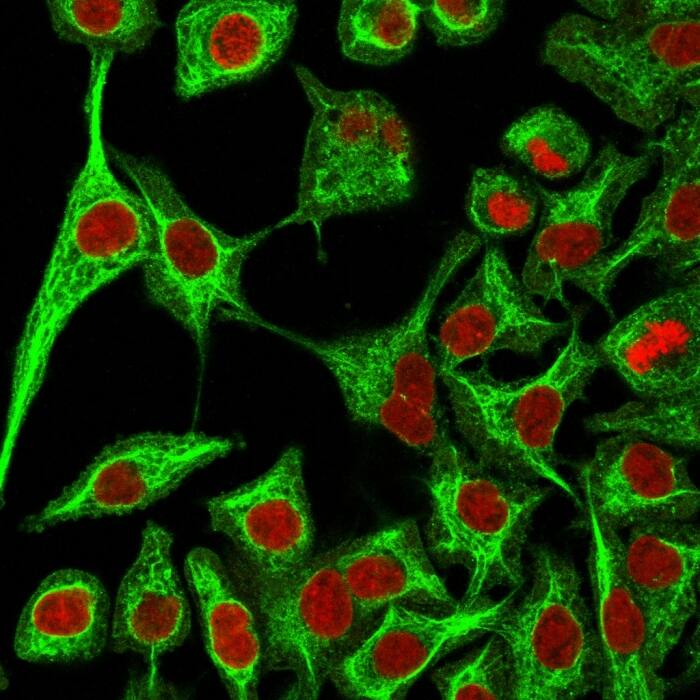 Immunofluorescence Analysis of A549 cells labeling KRT14 with Cytokeratin 14 Antibody (SPM263) - IHC-Prediluted followed by Goat anti-Mouse IgG-CF488 (Green). The nuclear counterstain is Reddot (Red).